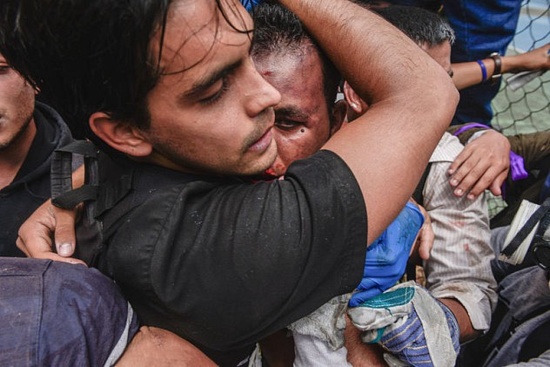 William Muñoz, étudiant bolivarien torturé par l'opposition fasciste au Venezuela