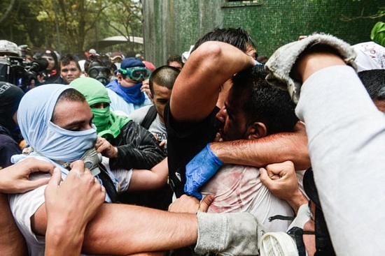 William Muñoz, étudiant bolivarien torturé par l'opposition fasciste au Venezuela