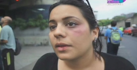 Wenderly Conde, l'autre étudiante agressée