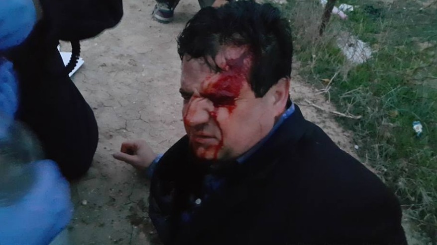 Violences israéliennes contre le député communiste Ayman Odeh (Hadash) et les bédouins du Neguev