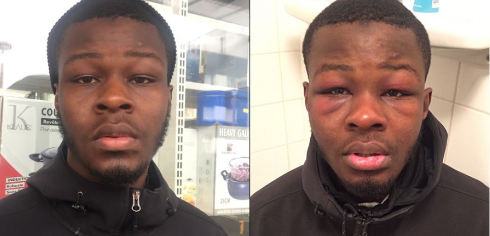Mohamed K., ami de Théo, raconte son passage à tabac par le même policier Mohamed K., ami de Théo, raconte son passage à tabac par le même policier