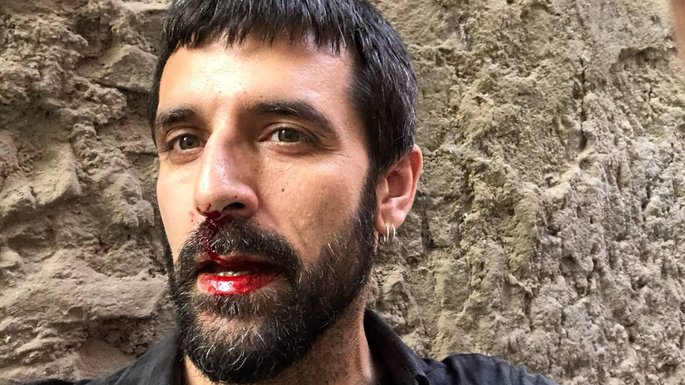 Catalogne : un photojournaliste agressé au cri de "Vive Franco !" par un policier espagnol