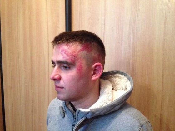 Nouvelle agression anticommuniste en Ukraine. A Kiev le fascisme est quotidien Nouvelle agression anticommuniste en Ukraine. A Kiev le fascisme est quotidien