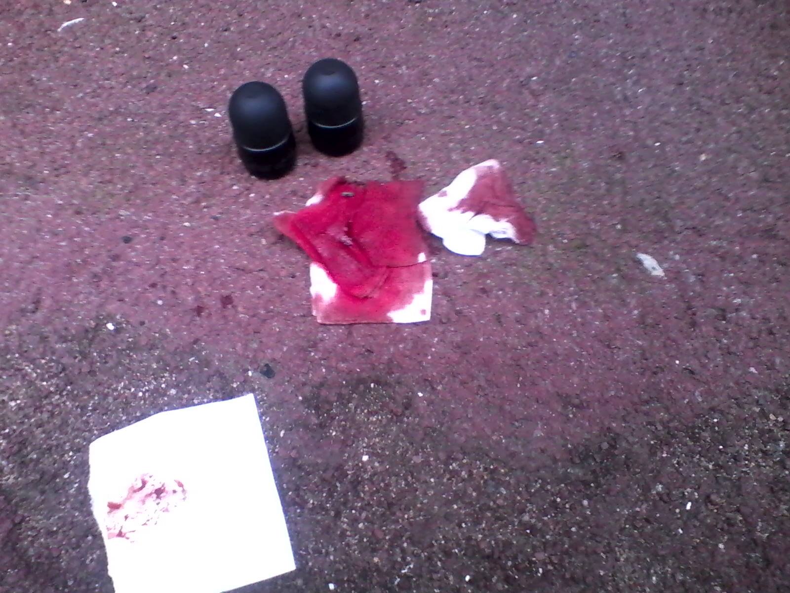 Loi Travail: L'étudiant blessé à Rennes pourrait perdre son œil