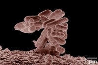 France: Bactérie E.coli et autres news