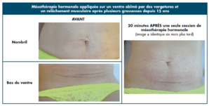 Retrouver UN VENTRE plat et FERME Retrouver UN VENTRE plat et FERME