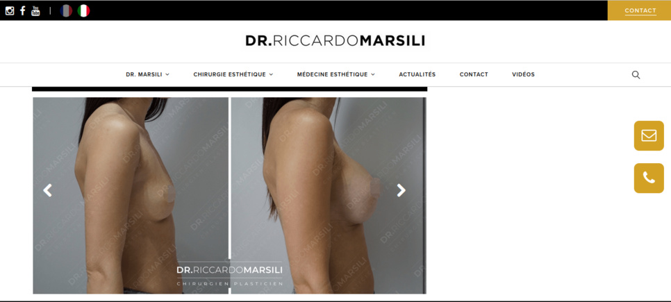 Augmentation mammaire Le Mans Augmentation mammaire Le Mans