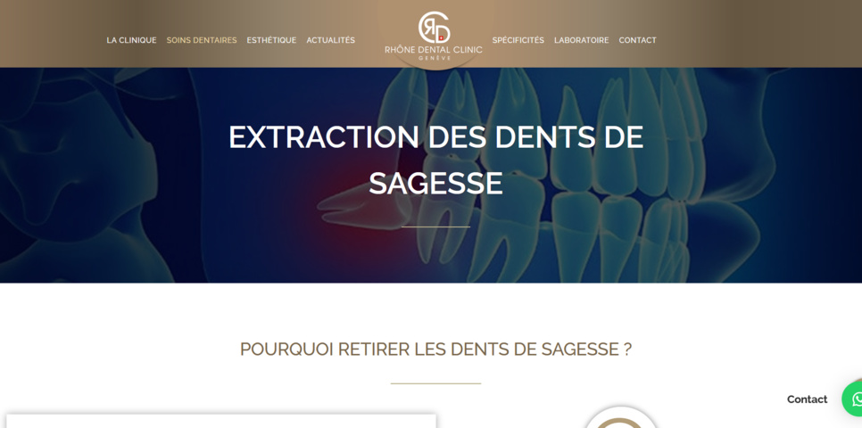 Soins des caries questions et réponses Soins des caries questions et réponses