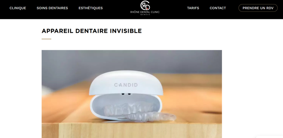 Aligneur invisible, questions et réponses Aligneur invisible, questions et réponses