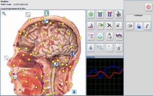 Découvrez la Biorésonance pour votre santé : Une approche révolutionnaire pour harmoniser votre corps et votre bien-être ! Découvrez la Biorésonance pour votre santé : Une approche révolutionnaire pour harmoniser votre corps et votre bien-être !