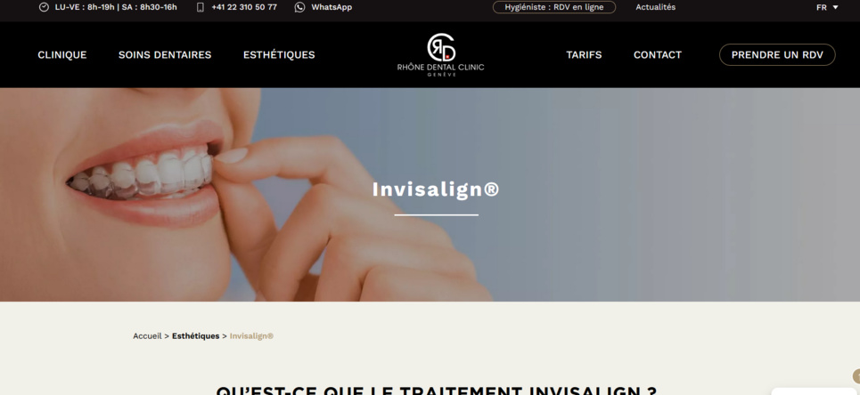 Solutions contre les dents jaunes ? Solutions contre les dents jaunes ?