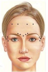 Médecine esthétique à Genève Médecine esthétique à Genève