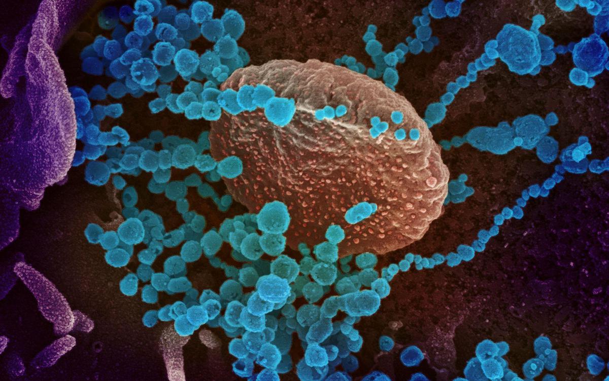 Un nouveau virus proche du Covid-19 inquiète les chercheurs en Russie