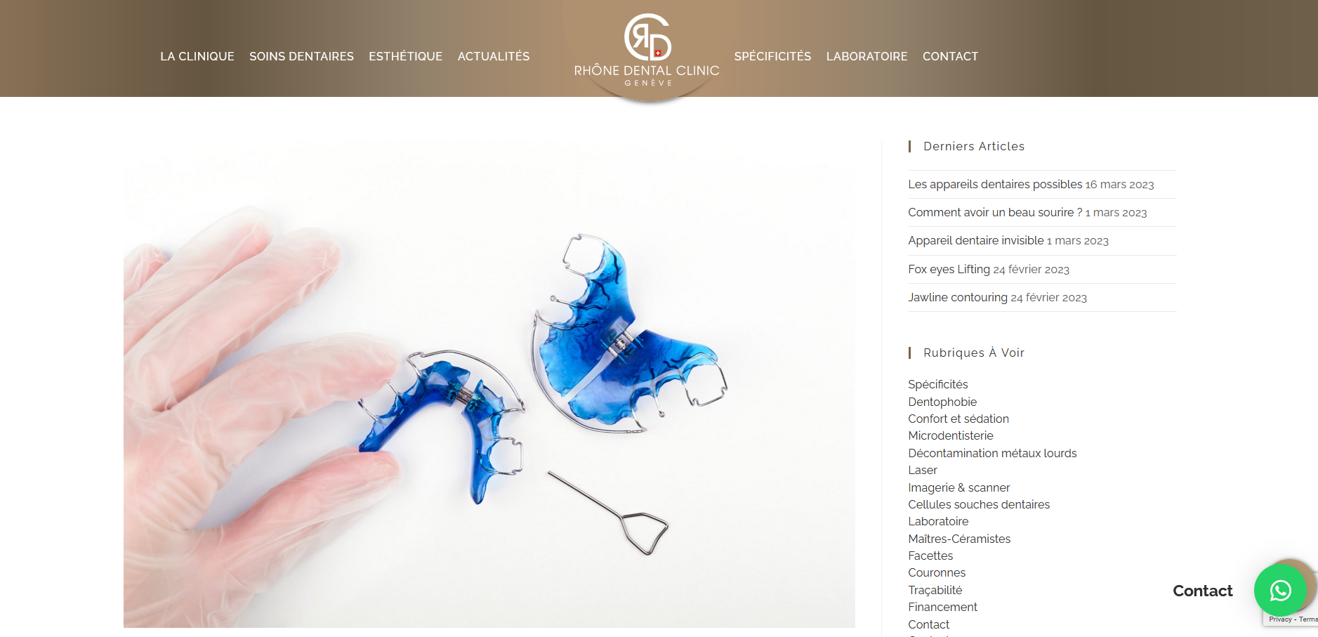 Appareil dentaire invisible, comment cela marche ?