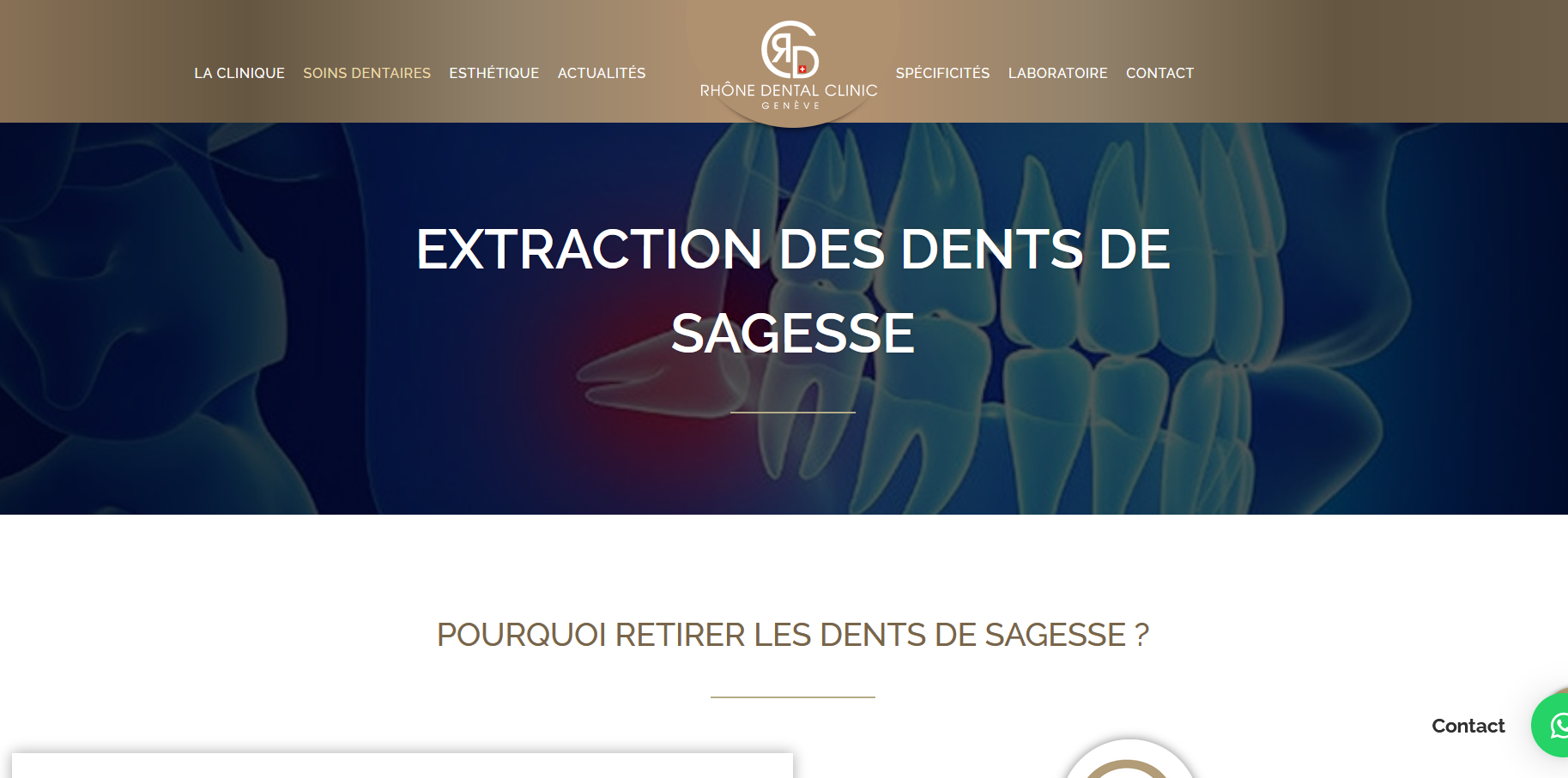 Extraction dents de sagesse Genève