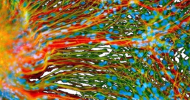 Cancer: la faute à pas de chance?