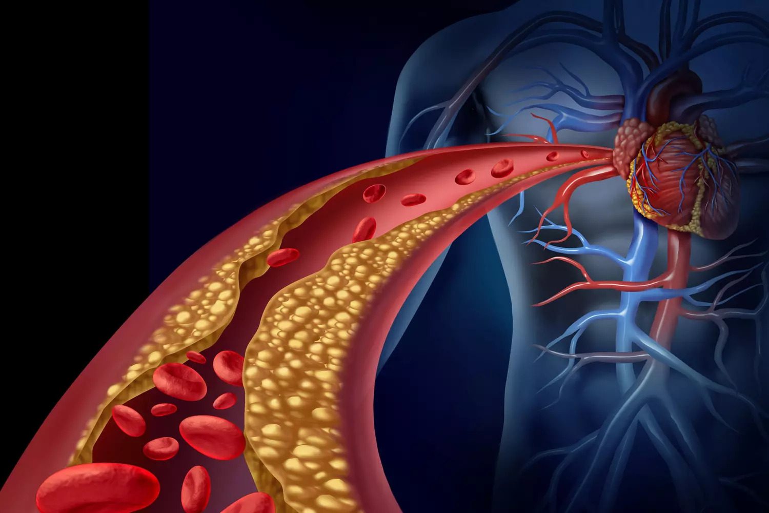 LIRE CECI POURRAIT SAUVER VOTRE VIE :  Cholesterol, cœur, plaques athéromes : Vous vous sentez en pleine forme ? C'est exactement le piège. ⚠️