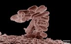 France: Bactérie E.coli et autres news