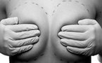 Insolite: l'implant mammaire qui explose