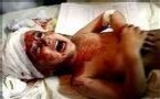 Violences à Gaza: la population civile souffre
