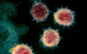 Les infections au Covid font leur apparition dans les zones rurales africaines