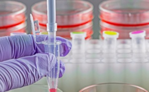 Cellules souches et thérapie cellulaire