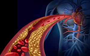 LIRE CECI POURRAIT SAUVER VOTRE VIE :  Cholesterol, cœur, plaques athéromes : Vous vous sentez en pleine forme ? C'est exactement le piège. ⚠️
