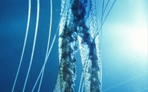 Insolites: elle perce un trou dans le pénis de son mari