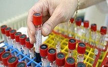 Santé: Cancers, des molécules porteuses d'espoir et autres infos