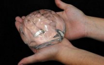 France: usine à scandale