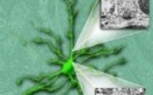 Un nouveau gène de l'autisme