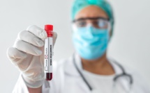 Variole du singe : La France compte désormais 91 contaminations confirmées, majoritairement chez des hommes entre 20 et 60 ans