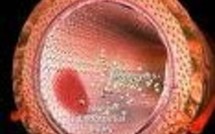 Ces globules blancs patrouilleurs