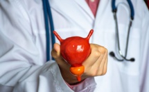 Mai, un mois pour parler du cancer de la vessie !