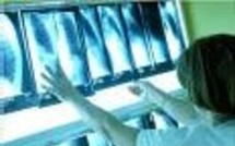 La carte génétique du cancer du poumon décryptée par des chercheurs