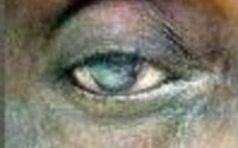 Editoweb actus dingues