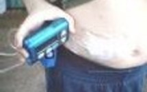 Santé: une nouvelle thérapie pour le diabète de type 2