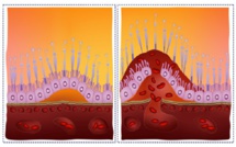 Dégénérescence maculaire liée à l’âge: prévention et thérapie