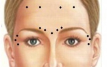 Médecine esthétique à Genève