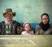 ÉLECTION LÉGISLATIVE DE JUILLET PROCHAIN : La grande peur des albinos