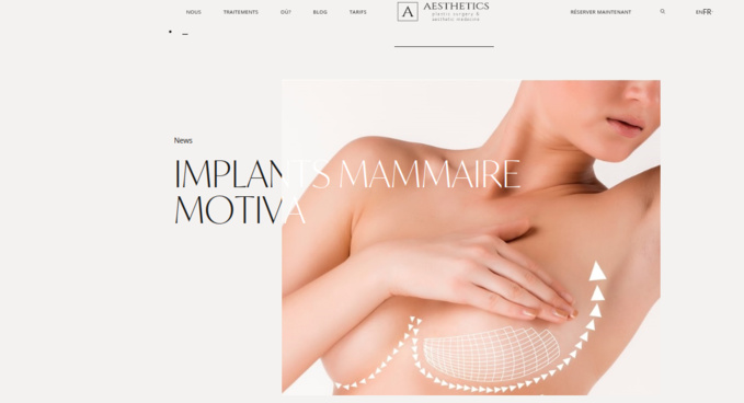 Implants mammaire Motiva Ergonomix