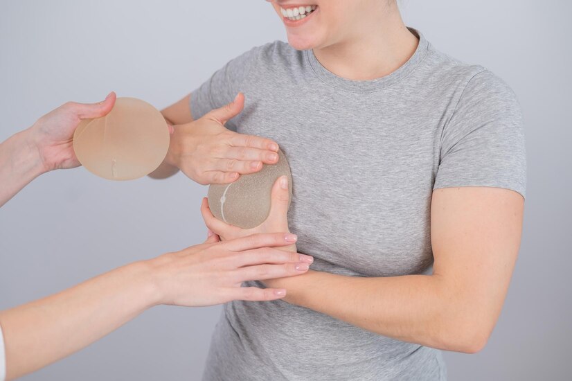 Comment se passe une augmentation mammaire par prothèses ? Le Docteur Riccardo Marsili de Paris nous en parle