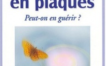 Soigner la sclérose en plaques à l'aide de traitements naturels